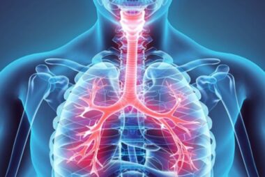 SOLUNUM YETMEZLİĞİ